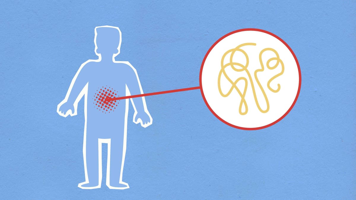 Immune Response